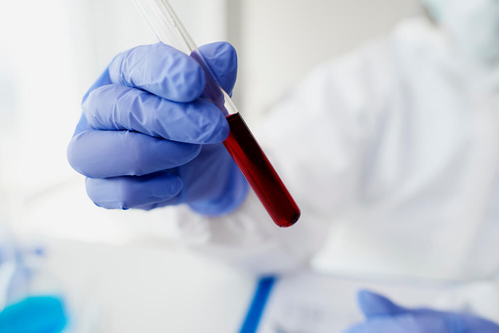 bloodtesttube (1)